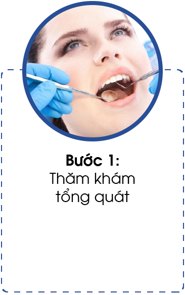 quy trinh nieng rang-01