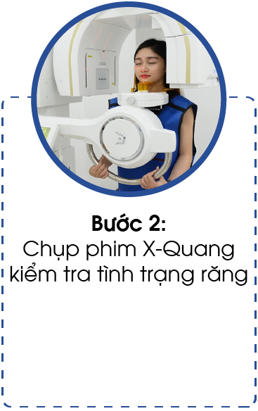 quy trinh nieng rang-02