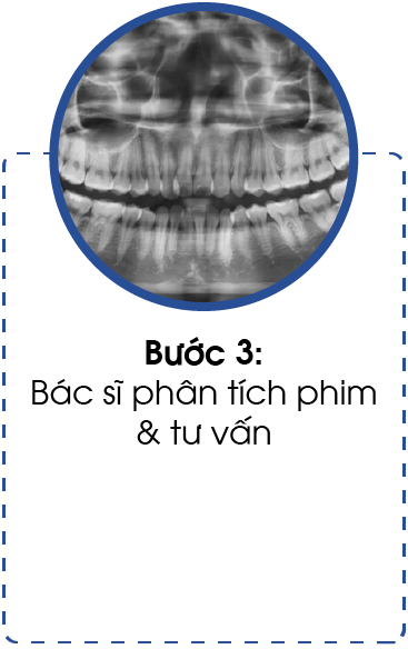 quy trinh nieng rang-03