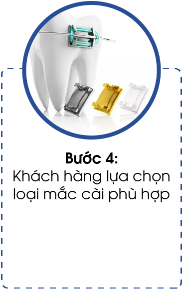 quy trinh nieng rang-04