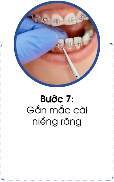 quy trinh nieng rang-07